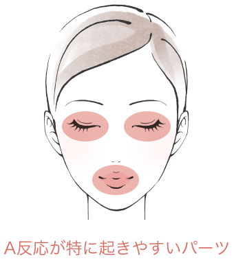 A反応が特に起きやすいパーツ